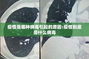 【疫情郑州商场 太原有开门吗/疫情郑州商场 太原有开门吗今天】