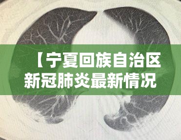 今日重大通报乐享牛牛“其实有挂”确实有挂√必胜开挂神器