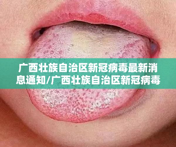 分享实测心悦拱牛真的有挂吗实测确实有挂